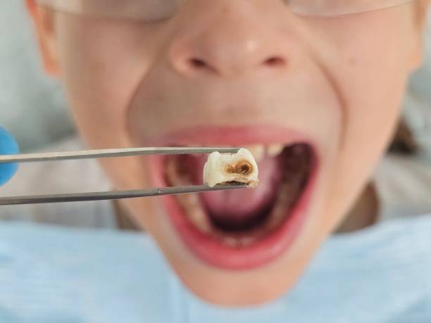 Best Emergency Dental Services for Seniors in Sunman, IN